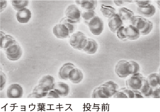 毛細血管の毛細血管の発達および再開通効果イメージ(02)